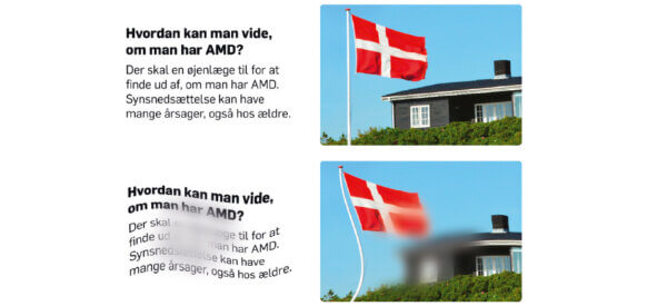 Aggressiv øjensygdom stjæler læsesynet