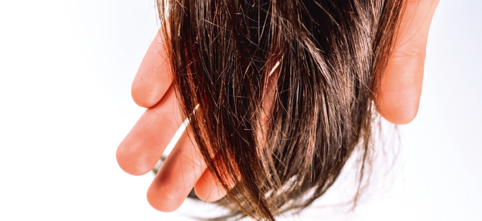 Håret kan sladre om din sundhed